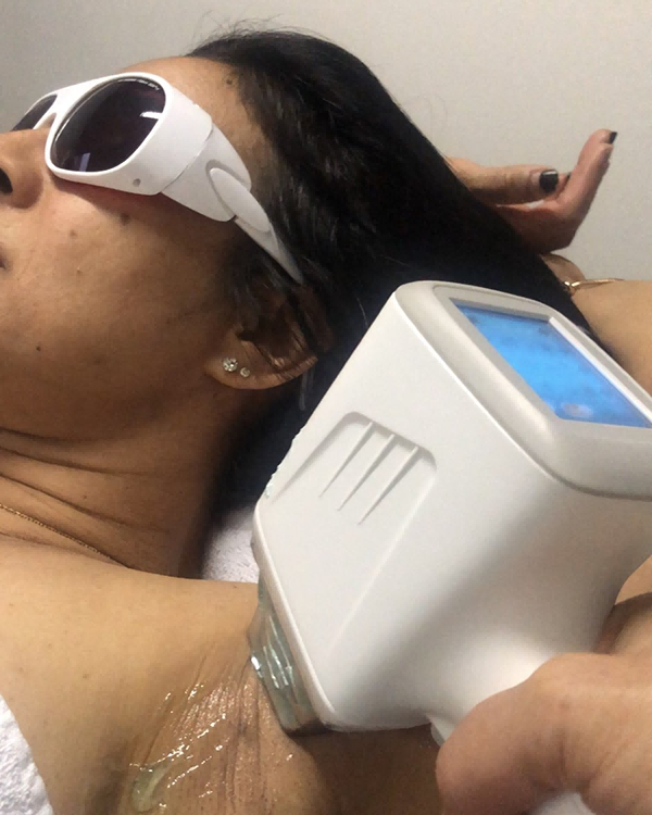 laser hair removal device feedback 1